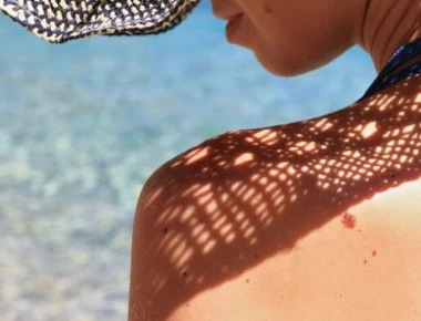 Σπίλοι: Πώς θα τους ελέγξετε